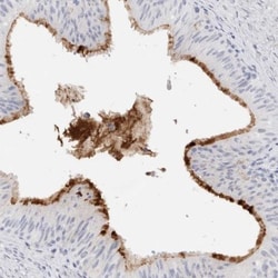 CROT Antibody, Novus Biologicals:Antibodies:Primary Antibodies